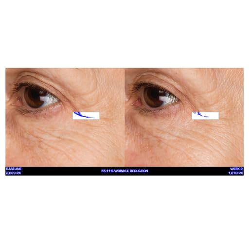 Serious Skincare Ultra-Mare Pure Marine Infusion Trio – Ultra-Mare Serum 1 oz, Ultra-Mare Facial Cream 2 oz. & Ultra-Mare Eye Cream .5 oz – Anti-Aging – Algae and Plankton extracts