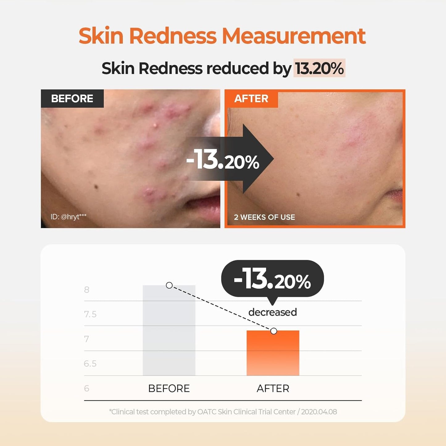 SKINFOOD Carrot Carotene Calming Water Toner Pads, Korean Skin Care Toner Pad for Face, Deep Hydrating, Soothing, After Sun Skincare for Sensitive Skin, Redness Relief, 100% Cotton, 8.81 oz (60 Pads)