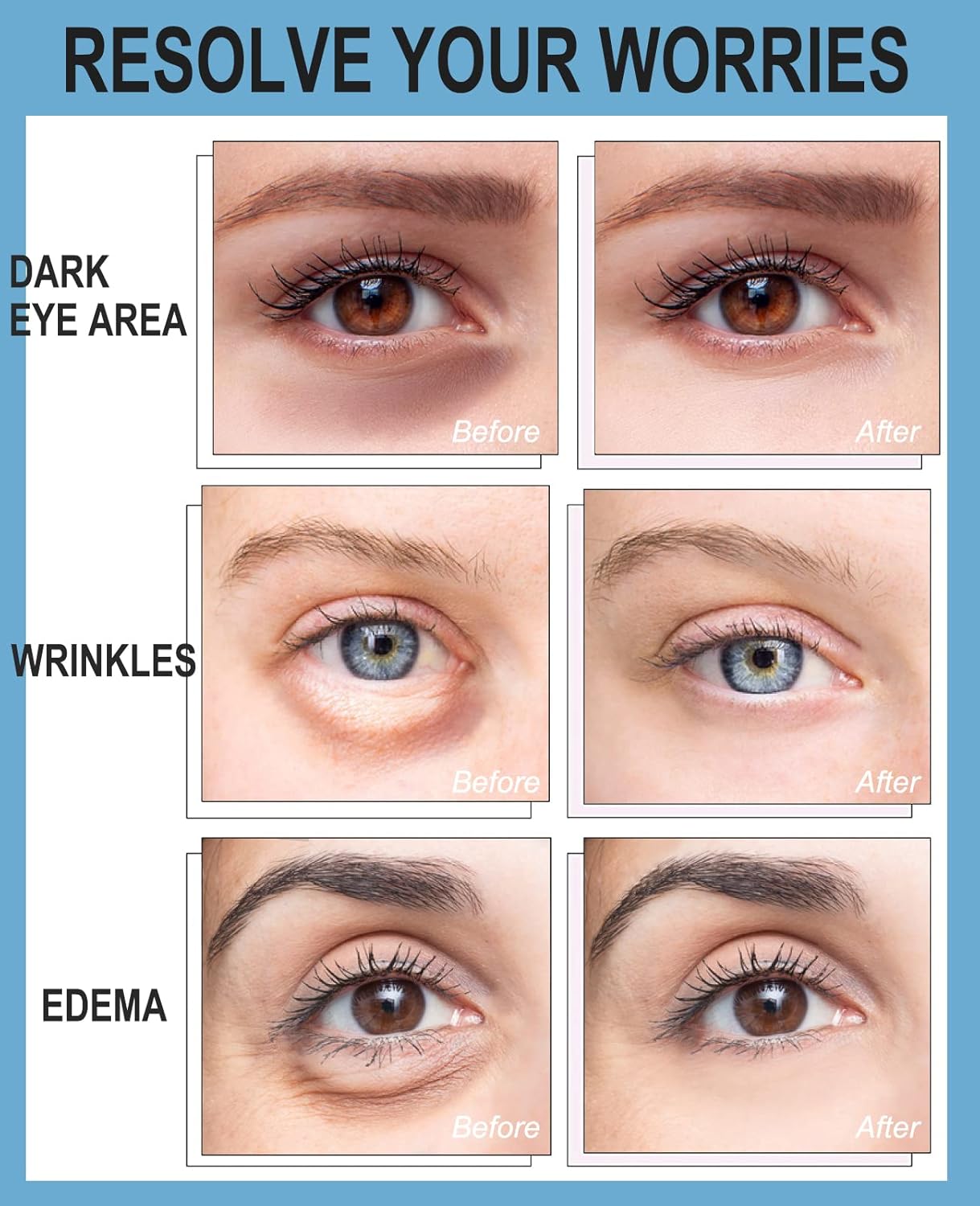 Collagen Under Eye Patches for Dark Circles and Puffiness Gold Color, Collagen Eye Masks Skincare for Puffy Eyes Gold Color