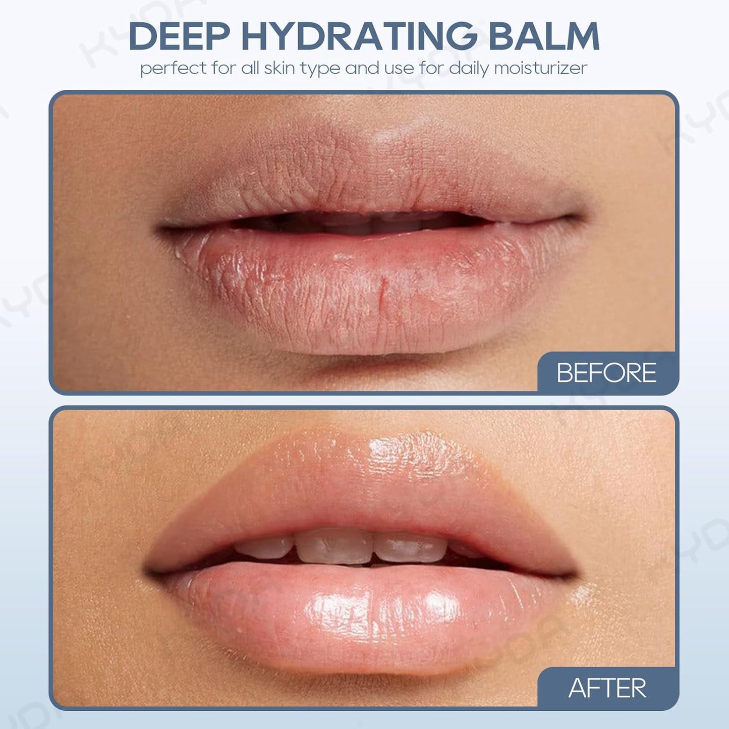 KYDA 3 Pcs Hyaluronic Acid Lip Balm, Moisturizing Lipstick for Dry Cracked Lips, Deep Hydrating Lip Care Balm, Reduce Fine Lines, Daily Lip Moisturizer with Hyaluronic Acid, Colorless Finish