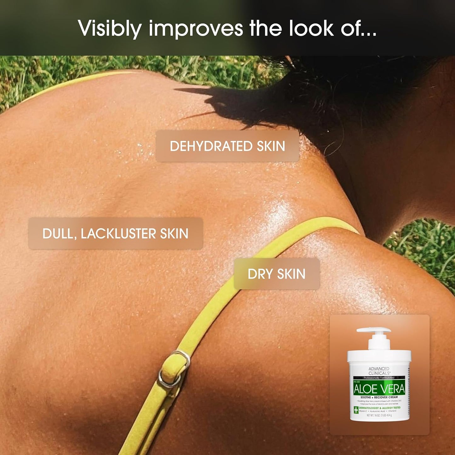 Advanced Clinicals Aloe Vera Lotion Skin Care Relief | Vitamin E Infused Hyaluronic Acid Moisturizer & Vitamin C Body Lotion For Women & Men Helps Improve Look Of Extremely Dry Skin, 16 Ounce, 2-Pack