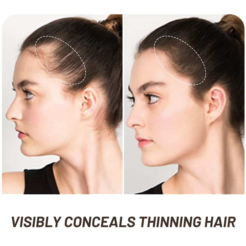 Root Touch Up Powder, Instantly Gray Root Cover Up Hairline Powder, Hair Concealer for Women and Men (A-Dark Brown, 2PC)