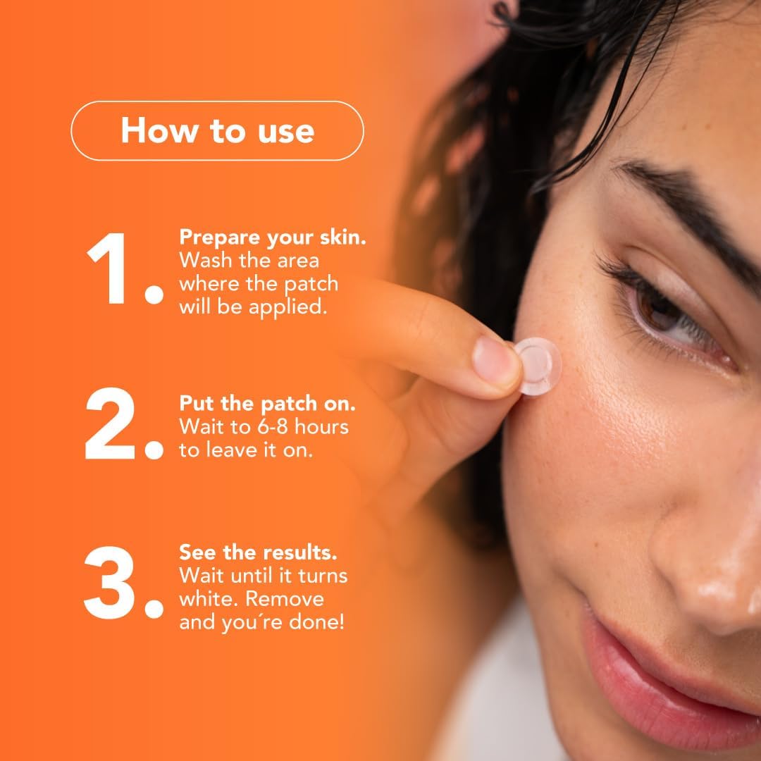 ALUX Skin Pimple Patches for Face, 180 Unit, Hydrocolloid Skin Care Acne, Safe for Sensitive Skin, Use Under Makeup, Absorbing Spot Cover Stickers for Zits, Blemishes, Pimples, Breakouts (6 pack)