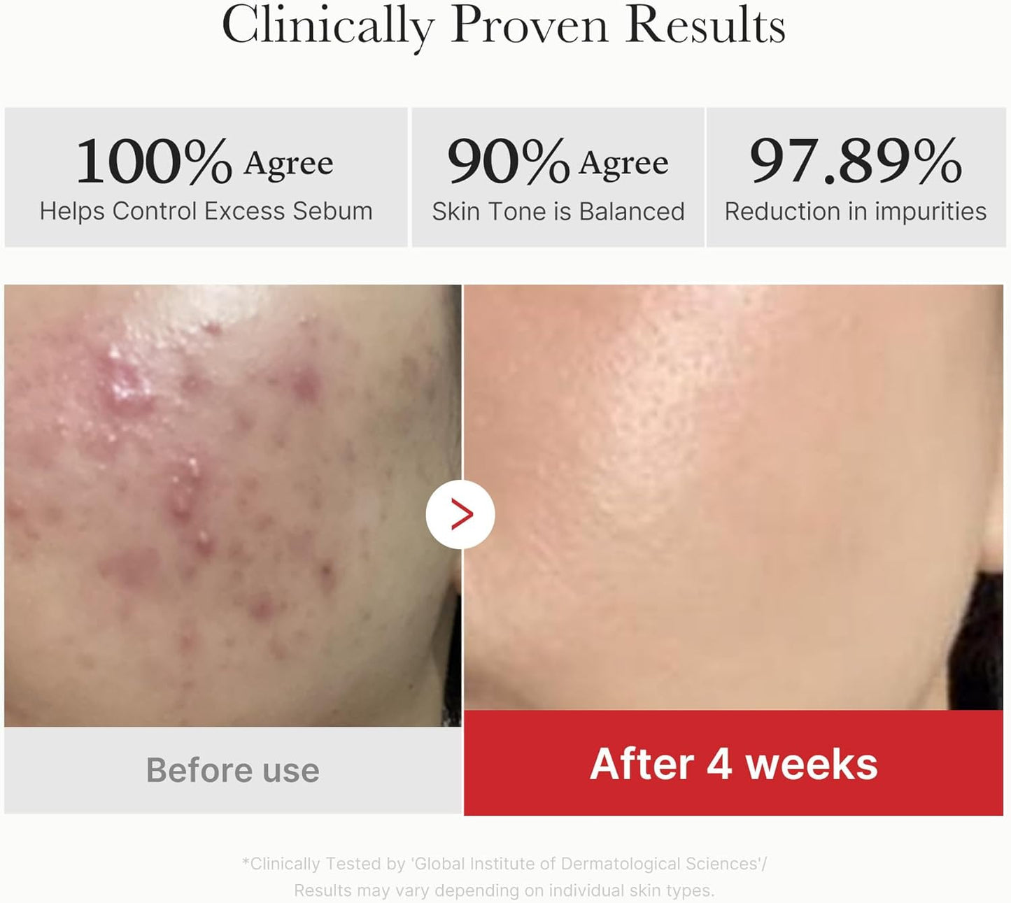 Medicube Red Succinic Acid Panthenol Facial Peeling Pads - Exfoliating Toner Pads for Breakout-Prone Skin with Niacinamide, AHA, BHA, and Soothing Panthenol - Non-Comedogenic