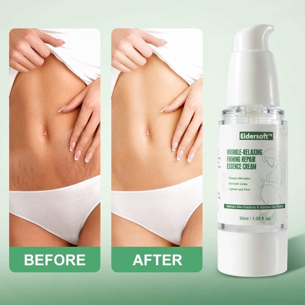 Wrinkle-Relaxing Firming Repair Essence Cream - Removes Maternity Stretch Marks, Prevents Wrinkles & Fine Lines, Nourishes & Rejuvenates Skin with Safe, Natural Formula