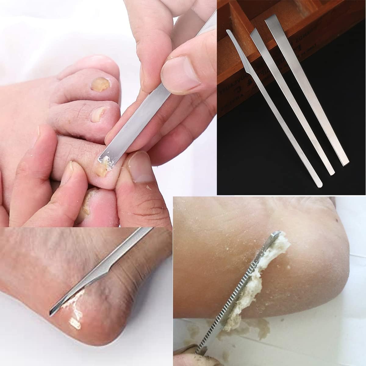 3PCS Stainless Steel ingrown toenail Pedicure Knife Set, Professional Foot Skin Scraper Repair Sharp Blade kit for Nail Corn Callus Paronychia Treatment (with Holes)