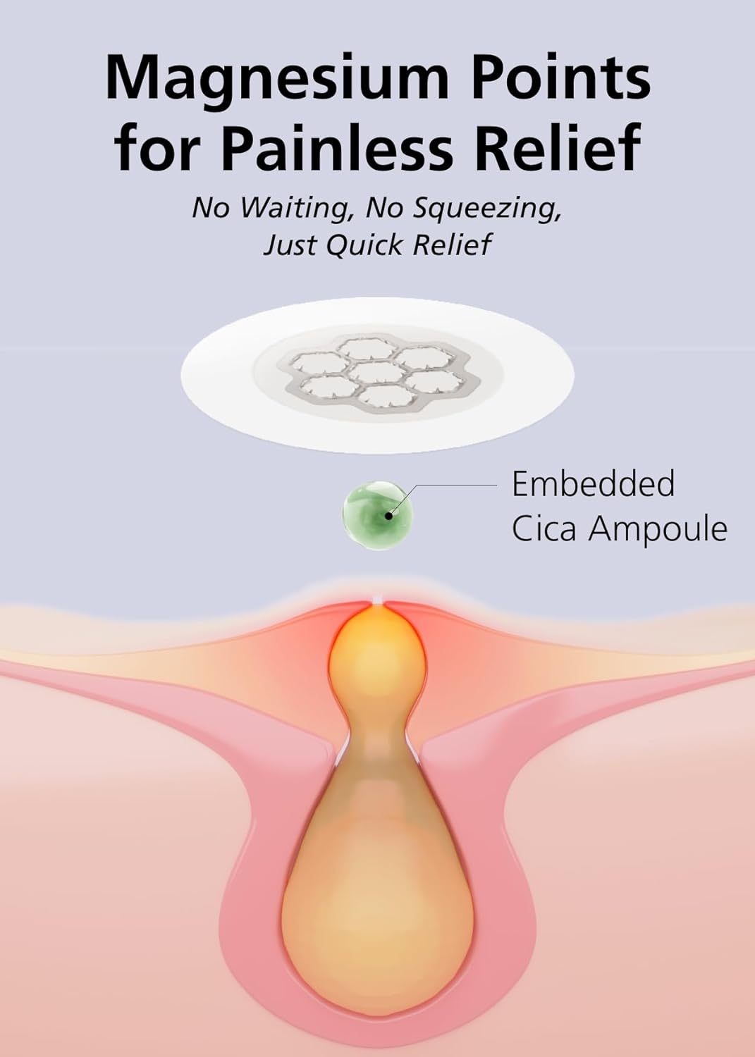 EasyDerm Quick Calming Magnesium Patches – Hydrocolloid Acne Spot Treatment Includes Tweezers & Ampoule, 10 Patches, Zit Sticker, Back to School MUST HAVE, Made by Daewoong Pharmaceutical