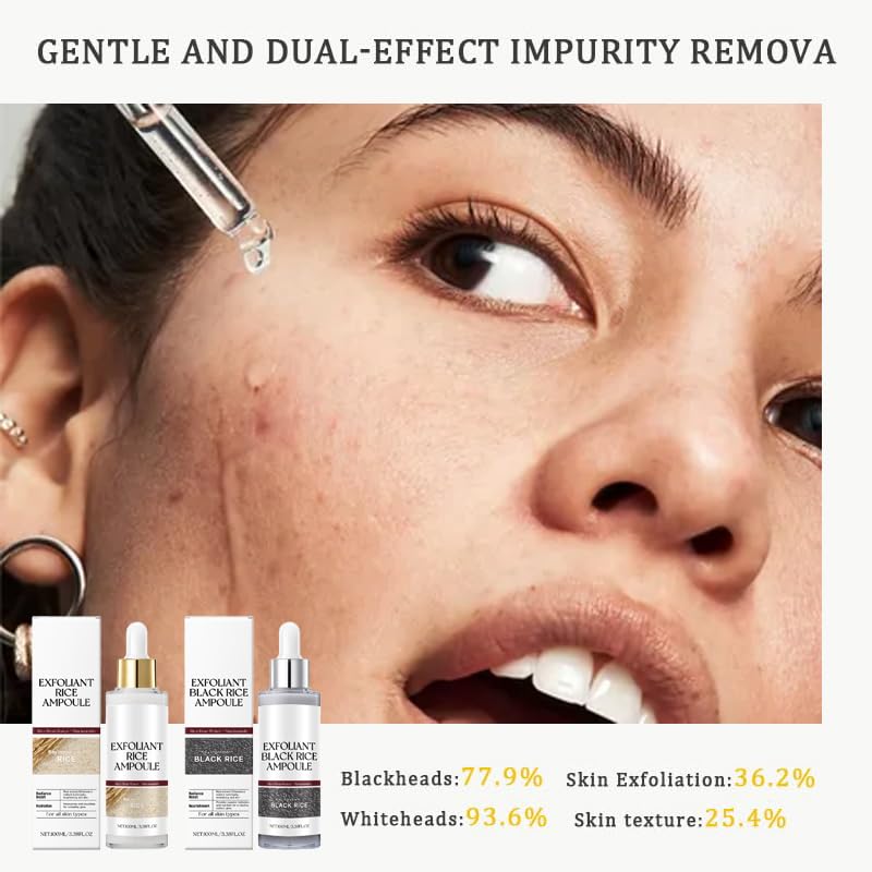 Black and White Rice Peeling, New Soft Rice Exfoliating Face and Body, Black and White Rice Exfoliant for All Skin Types, Gentle Peel & Deep Hydration (White+Black) 2pcs