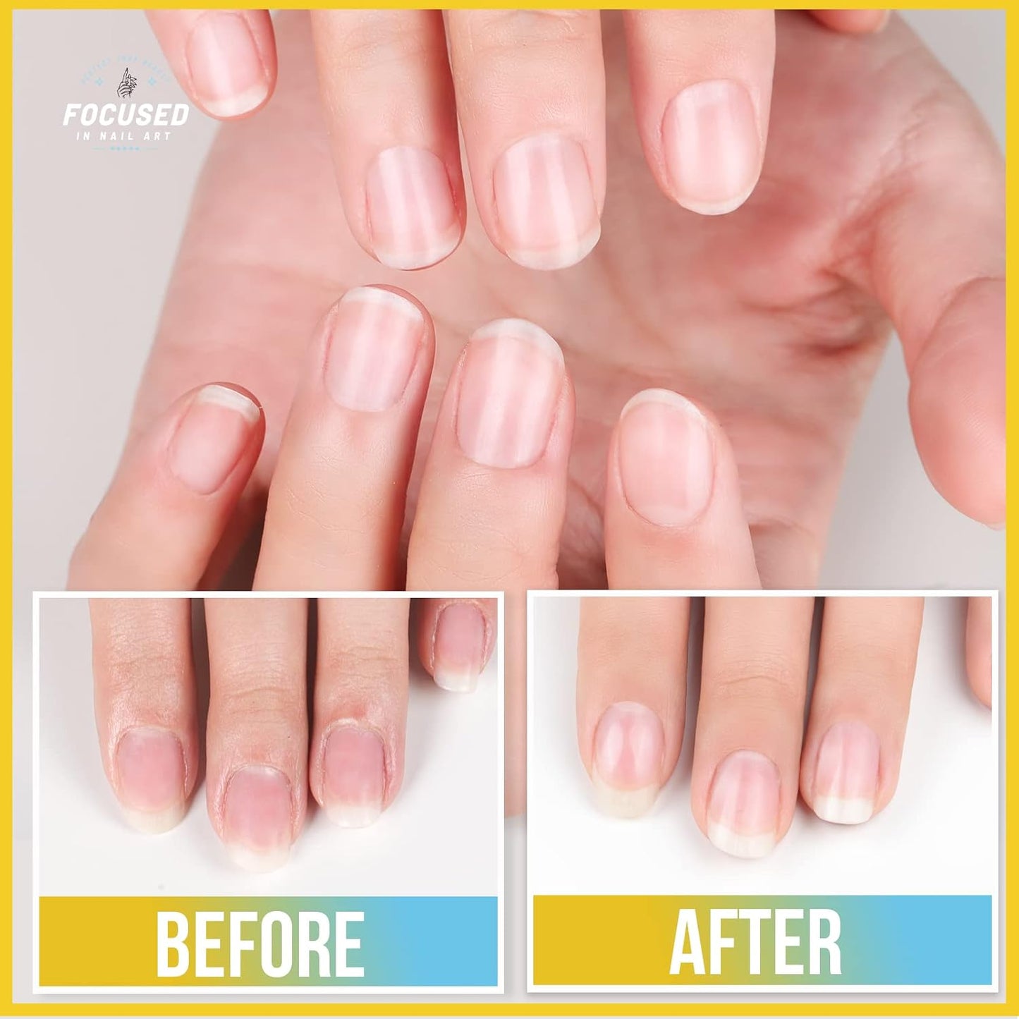 Teenitor Cuticle Remover Cuticle Remover Kit, Nail Care Kit with Cuticle Remover Cuticle Oil Nail File Nail Buffer Cuticle Pusher, Cuticle Peeler Scraper, Manicure Care Tools Milk and Honey