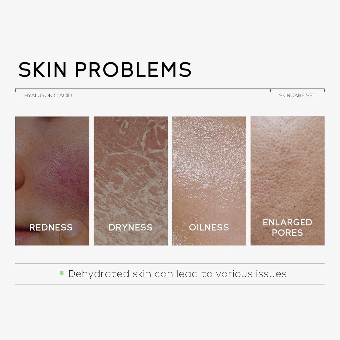 Skin Care Set, Hyaluronic Acid Travel Size Skincare Set W/ Low pH Cleanser, Moisturizer, Serum, Eye Cream, Toiletry Bag, Face Care Set Gift for Women Girls, Hydrating Anti Aging for Dry Skin