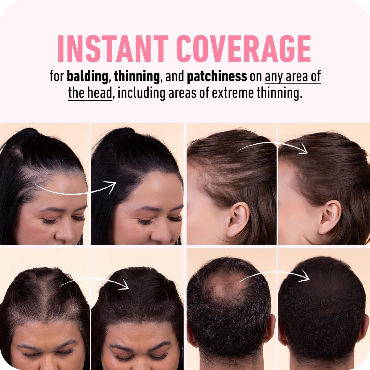 BOLDIFY Hairline Powder (LARGE, 10g) - Root Touch Up Hair Color for Gray Coverage - Bald Spot Concealing Hair Powder for Women & Men - 48-Hour Stain-Proof - Dark Brown