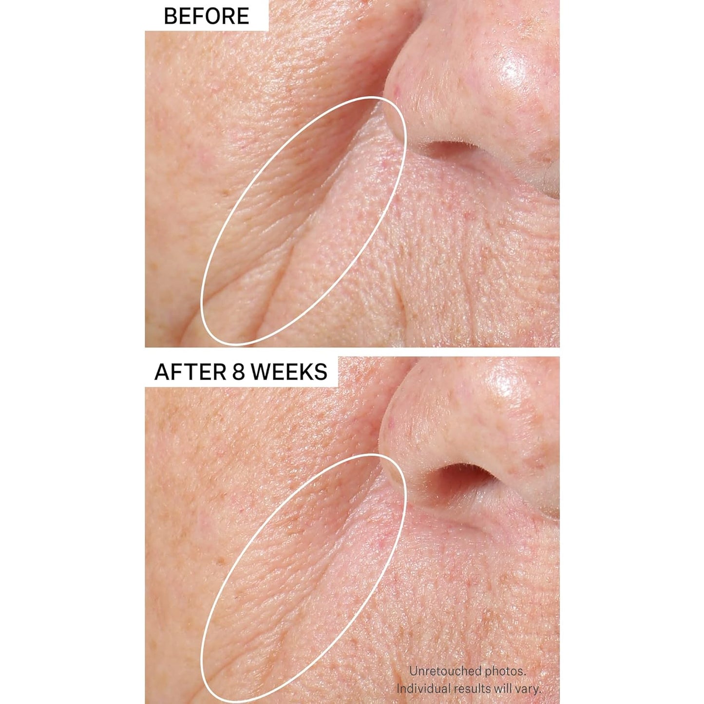 StriVectin Tighten & Lift Peptight Tightening & Brightening Face Serum with Peptides for Even Skin Tone, 1.7 Fl Oz