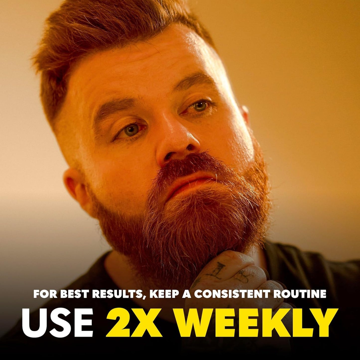 The Beard Club Derma Roller for Face, Body and Scalp - Microneedling for Men and Women with 540 Titanium Microneedles - Beard Roller & Micro Needling Scalp Hair - Yellow & Black