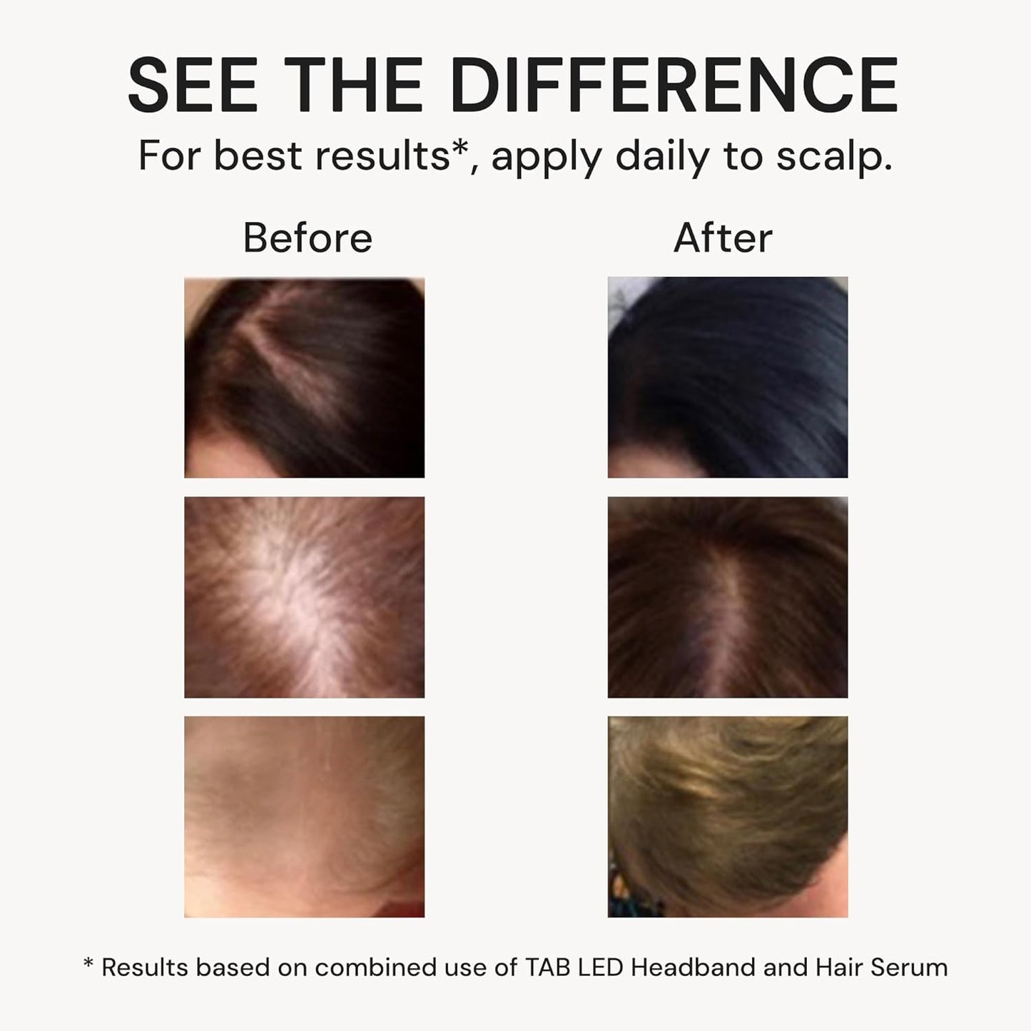 TAB Tech Activated Hair and Scalp Serum, Hair Loss Support Formula without Minoxidil for Men & Women, Oil-Free, Lightweight, Daily Leave-In, Non-Greasy, Fragrance-Free, Fast Absorbing - 2.7 fl oz