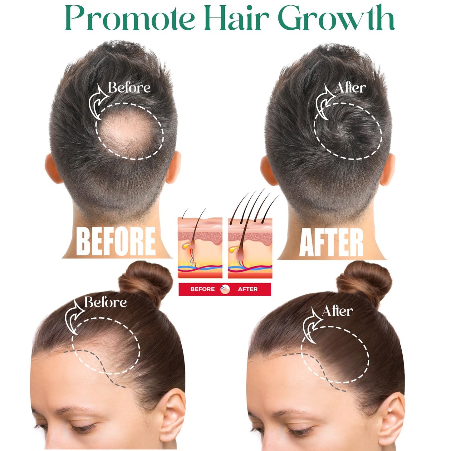 JSK Hair Growth Shampoo & Conditioner Set Biotin & Rosemary for Thinning Hair, DHT Blockers, Hair Care Kit for Men & Women, Includes Scalp Massager & Bonnet, Sulphate-Free Thickening & Moisturizing