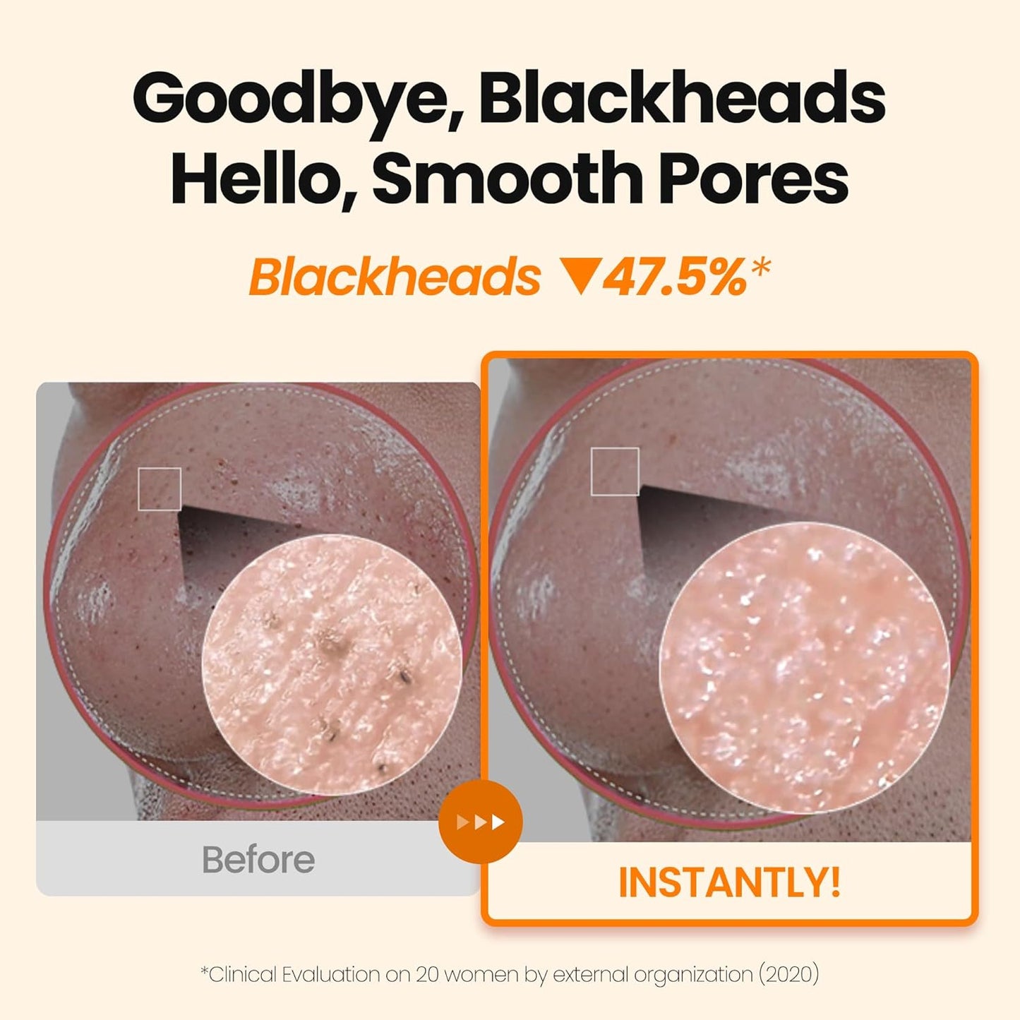 [K-Beauty] Calendula Biome Oil to Foam - All-in-One Korean Face Wash OilBased Foaming Facial Cleanser - Hydrating, Moisturizing & Soothing Makeup Deep Cleansing Oil for All Skin Types (3.88 fl oz)