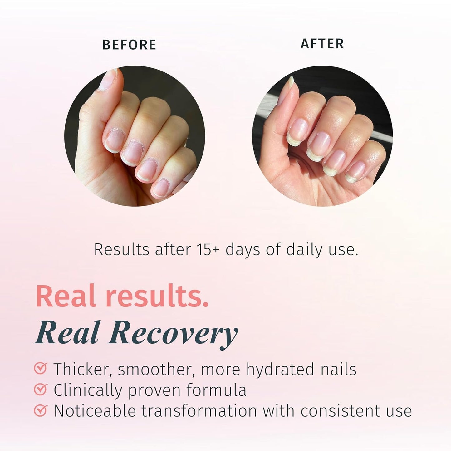 duri Rejuvacote 1 Original Maximum Strength Nail Growth System Base, Top Coat - Nails Hardening, Repair, Chipping, Strengthen, Breaking and Brittle Treatment, by Duri cosmetics (Pack of 1)