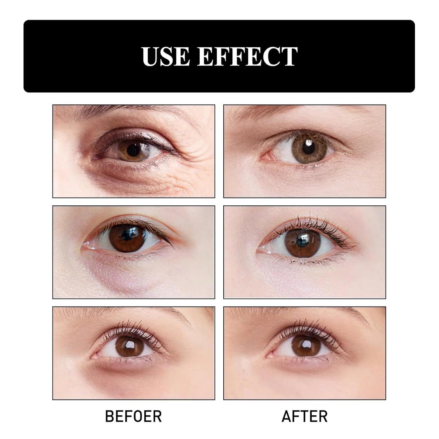 Firming Eye Cream, Snake Venom Peptide Eye Cream, Daily Anti-Aging Under Eye Cream, Remove Pouches Dark Circles Anti-Wrinkle Diminishing Eye Lines Lifting Firming