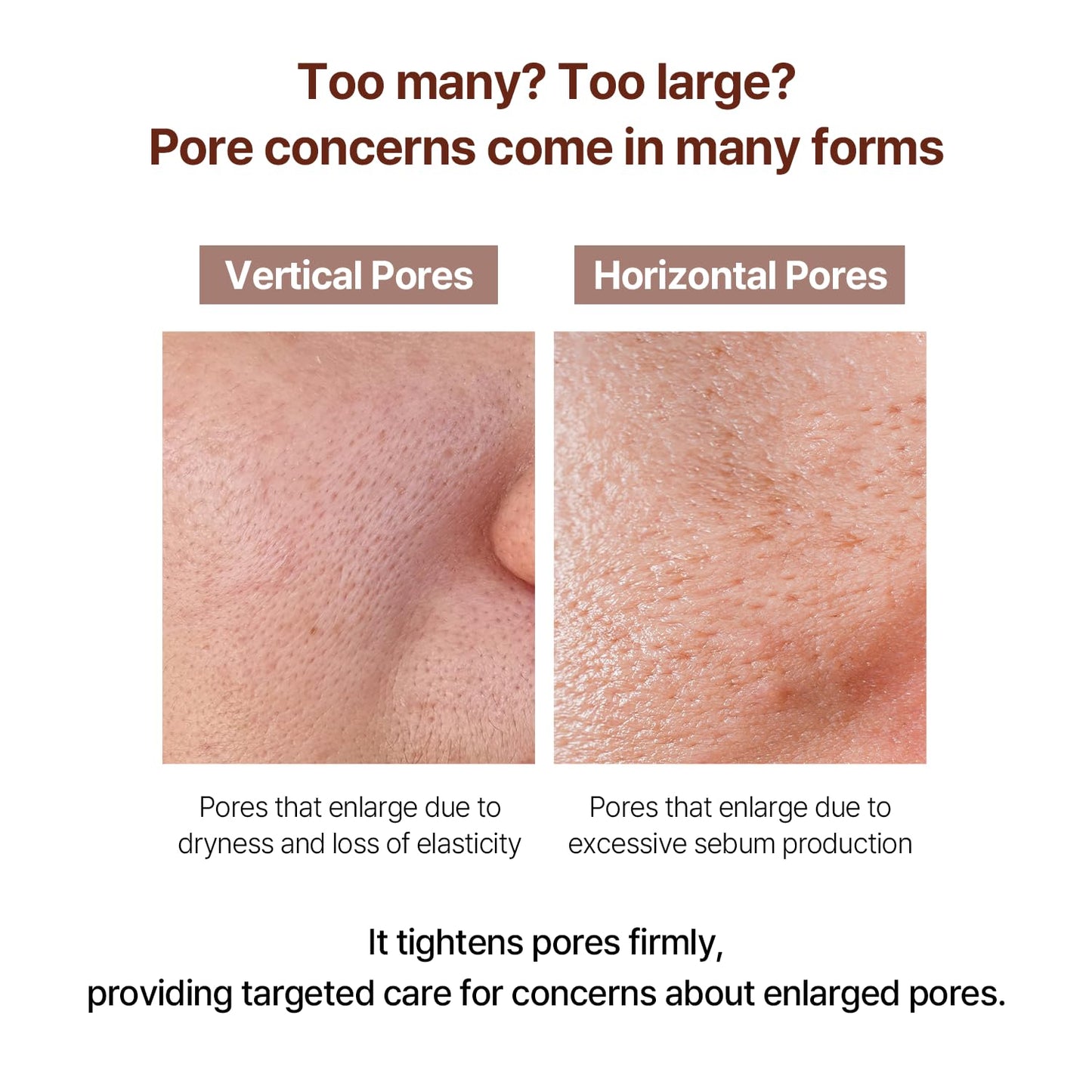 AVCA Pore Fit Retinol Ampoule for Large Pores, Fine Lines, Anti Aging & Wrinkle Care 100ml/3.38fl. oz.