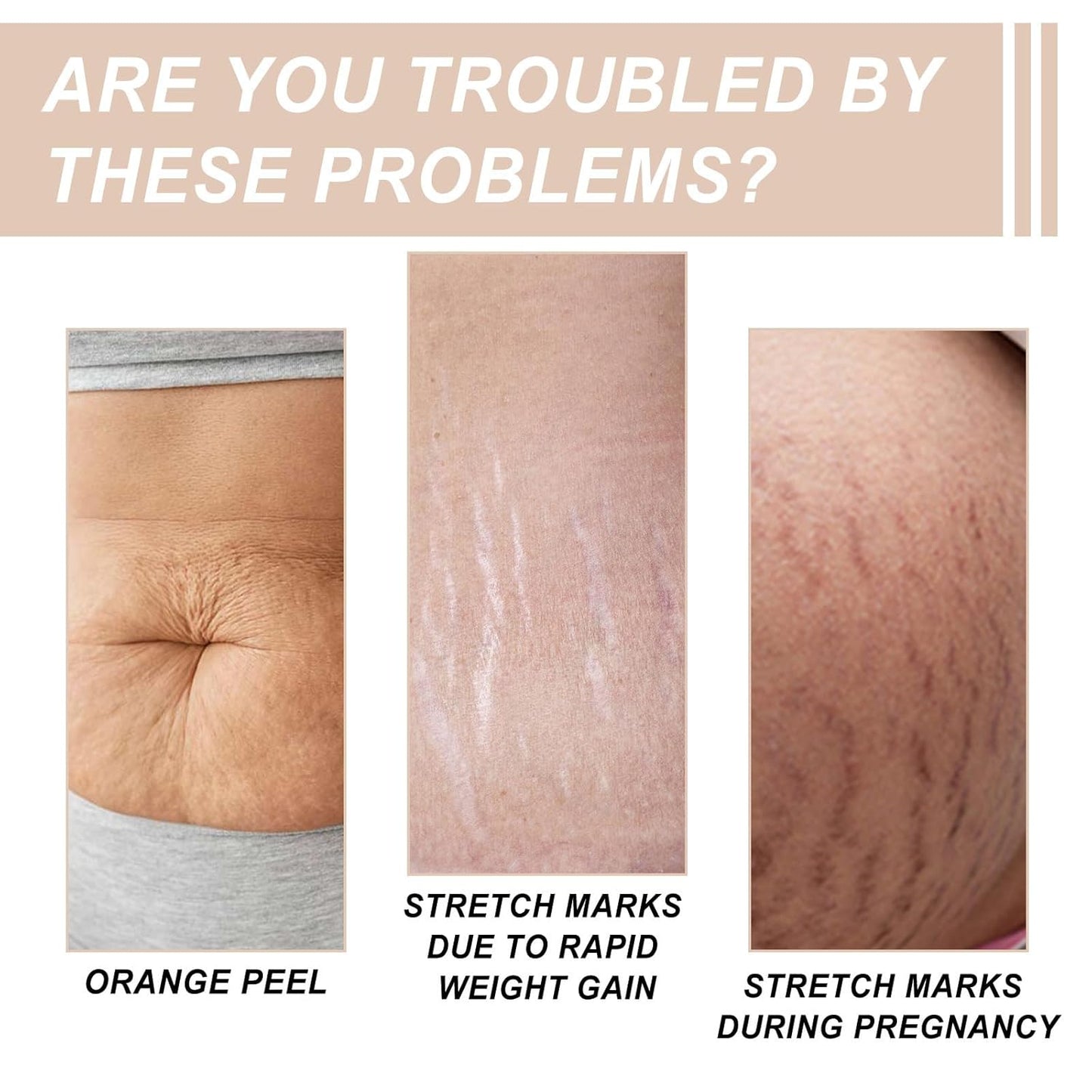 Butter Drench Restorative Rich Face Cream, Reduces Pregnancy Repair Skin, Hydrating Face Lotion, Helps Skin Retain Moisture, Soothes Dry Skin