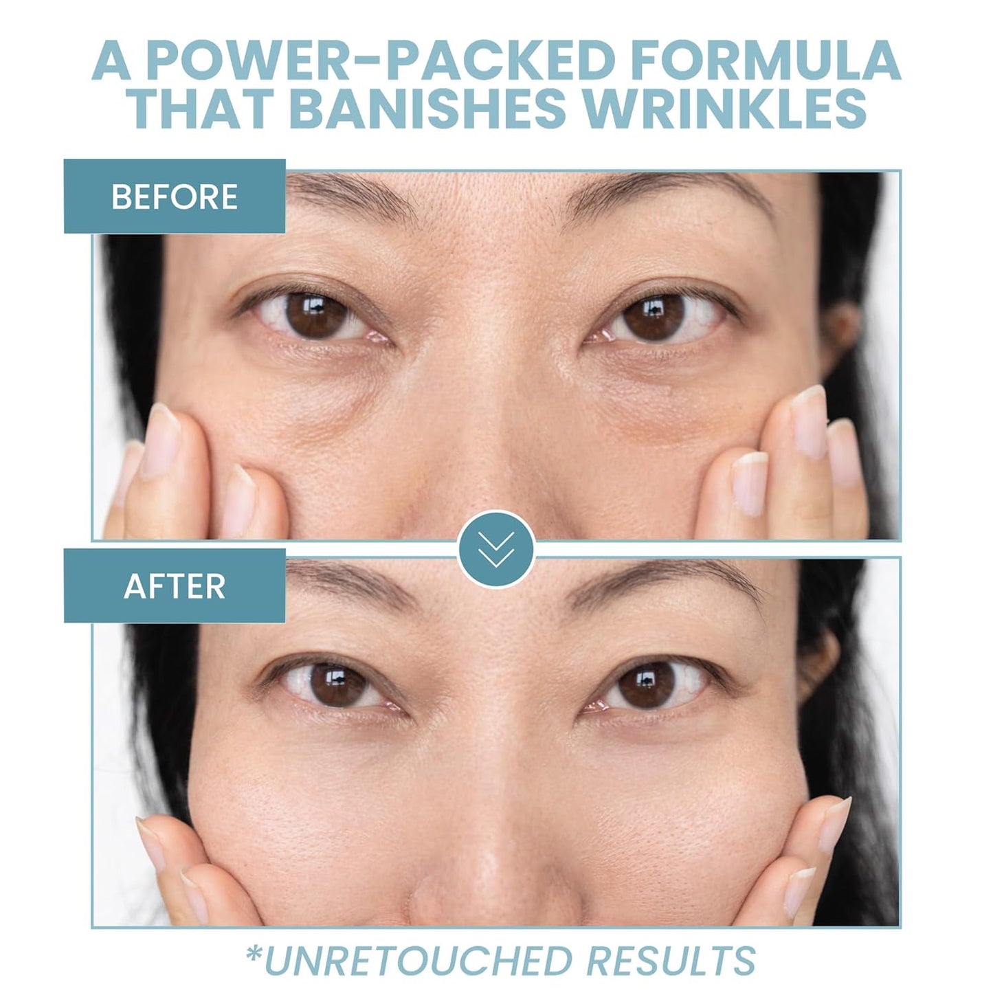 Anti-Aging Eye Gel - Luxurious Hydrating Under Eye Cream For Dark Circles and Puffiness, Bags, Crows Feet, Wrinkles - With Hyaluronic Acid & Skin-Firming Peptides Eye Serum (2 oz.)