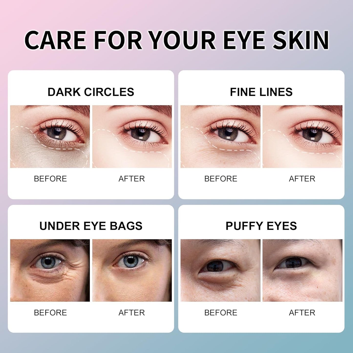 ROUSE Sakura Under Eye Patches-60 PCS- Anti-Wrinkle Eye Mask Hydrating Eye Gel Pads Dark Circles Puffy Eyes Under Eye Bags Fine Lines Eye Treatment Masks for Women & Men