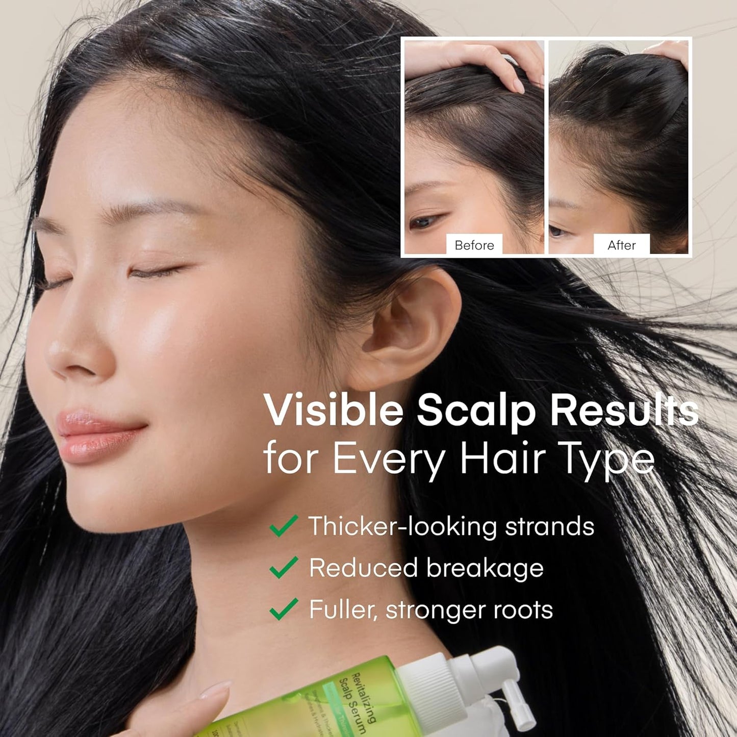 Scalp Serum Hair Growth Spray - Korean Leave-In Vegan Tonic with Niacinamide & Panthenol to Strengthen Roots, Thicken Hair, Hydrate & Nourish Scalp, Reduce Thinning