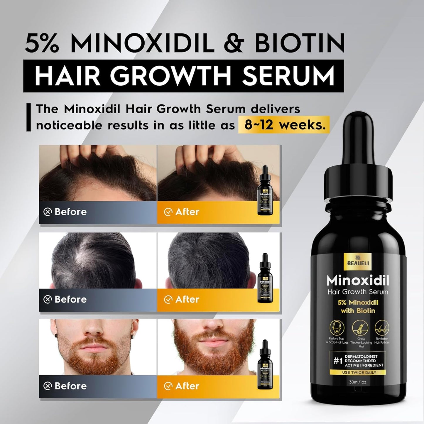 5% Minoxidil Hair Growth for Men and Women: Extra Strength Minoxidil Regrowth Treatment Serum for Thinning Hair Loss to Grow Thicker Fuller Faster 30ml 3Bottles