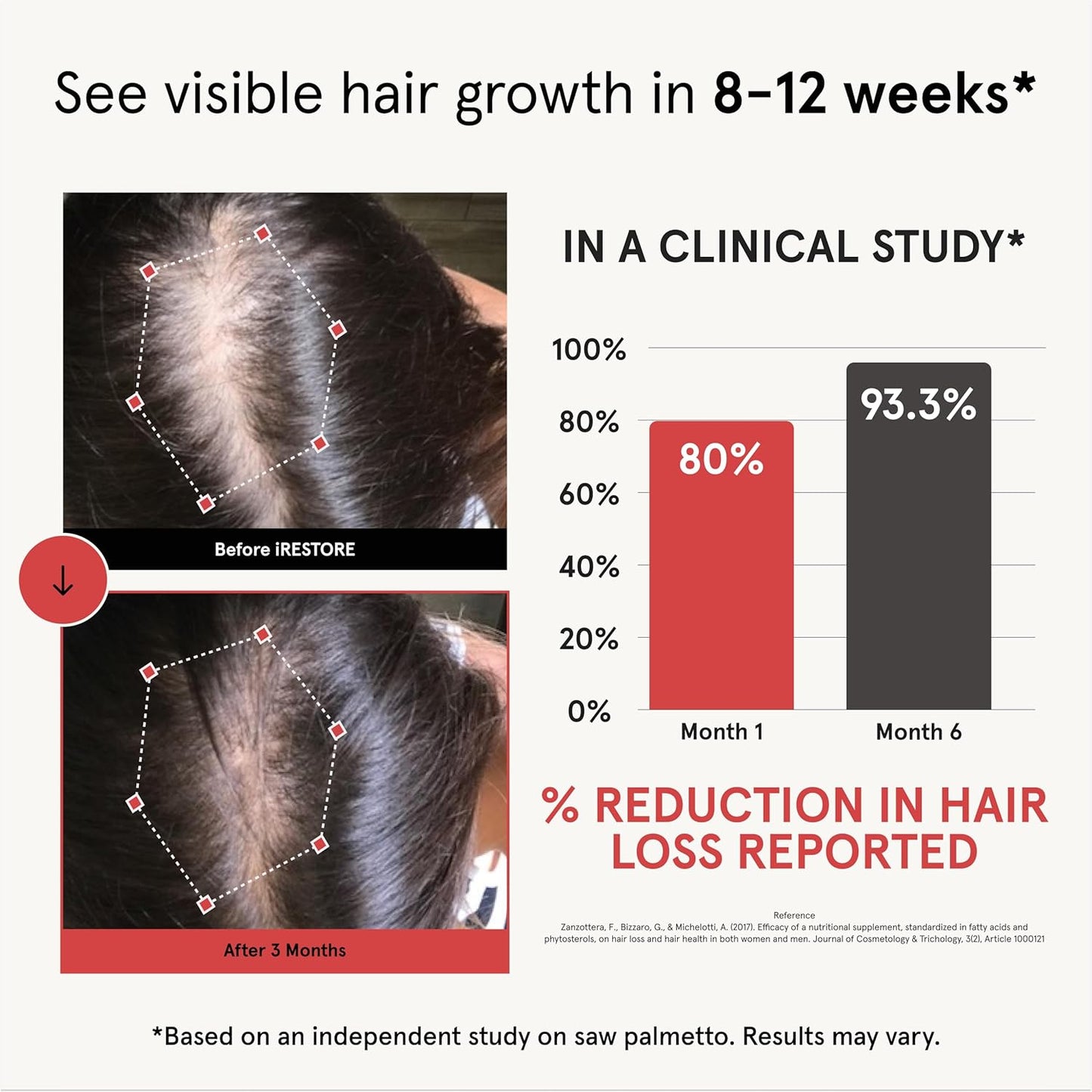 iRestore Hair Growth Supplement - Hair Loss Vitamins for Women and Men - Biotin Multivitamins & DHT Blocker to Reduce Hair Thinning - Hair Regrowth Pills - 30 Days Supply 90 Count (Pack of 1)