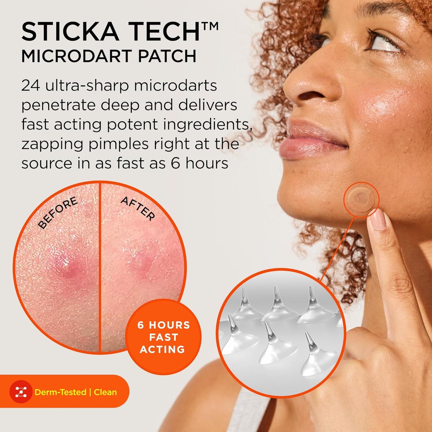 ZitSticka Killa Pimple Patches for Face - World's Most Potent Pimple Patch with Fast-Acting Microdarts - Starts Working within 6 Hours for Deep, Early-Stage Zits - Regular 8 Count with Cleana Swab