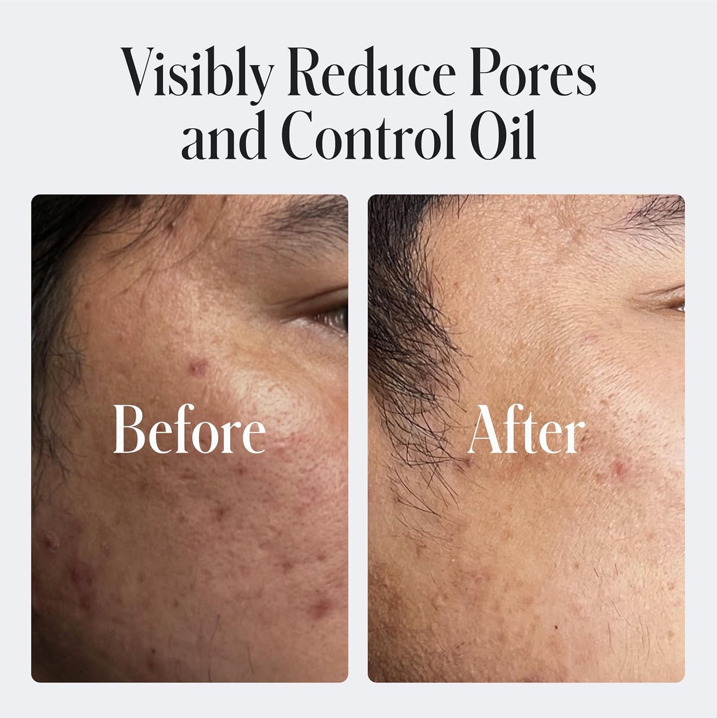 Geologie 2% Salicylic Acid Face Wash Bergamot + Juniper Scent | Facial Cleanser for Men & Women | Acne & Oil Control | Deep Cleansing & BHA Exfoliating Face Wash | 2-Pack