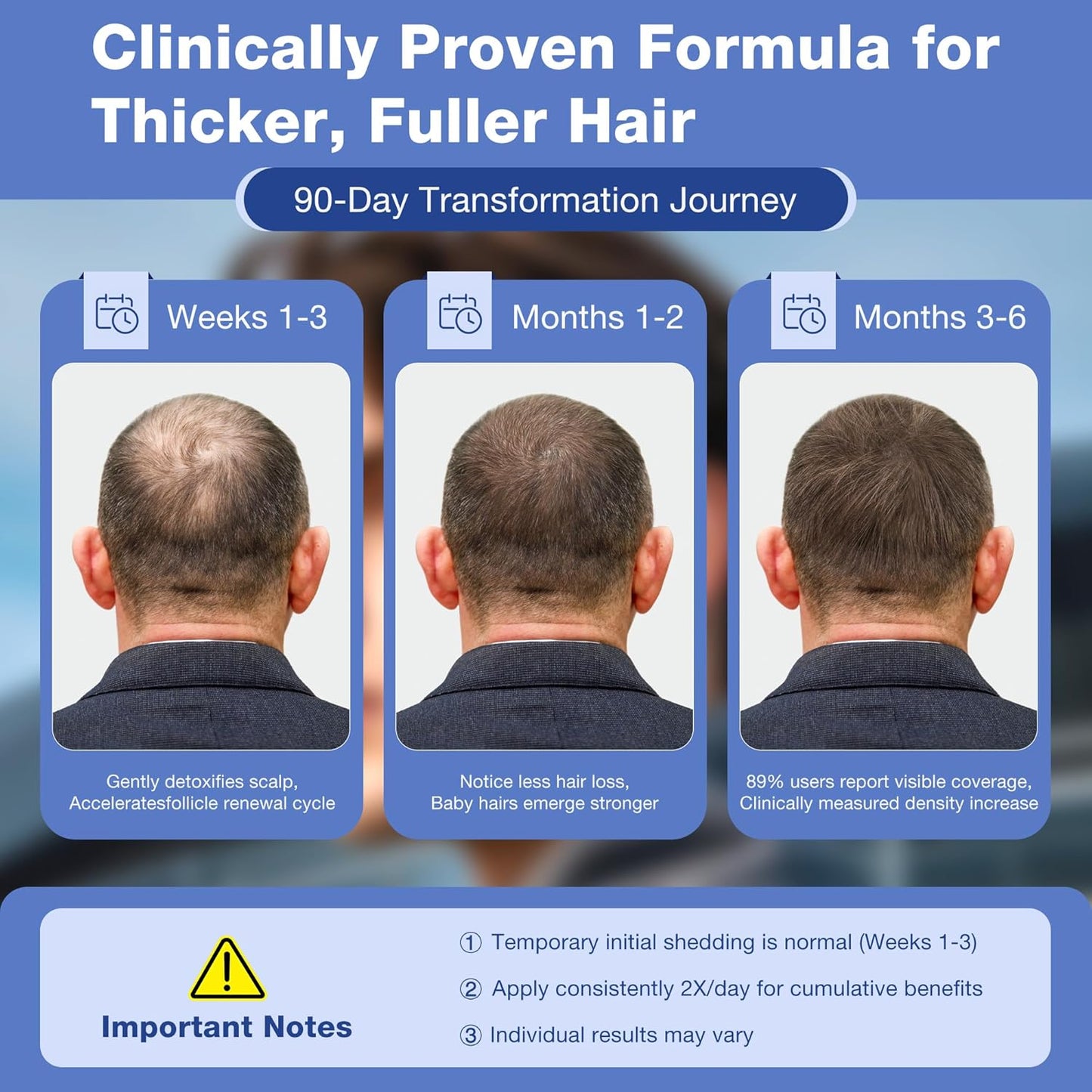 5% Minoxidil for Men Hair Growth Serum - Minoxidil for Women Serum with Biotin for Thicker & Healthier, Topical Minoxidil for Men Restore Fuller Beard