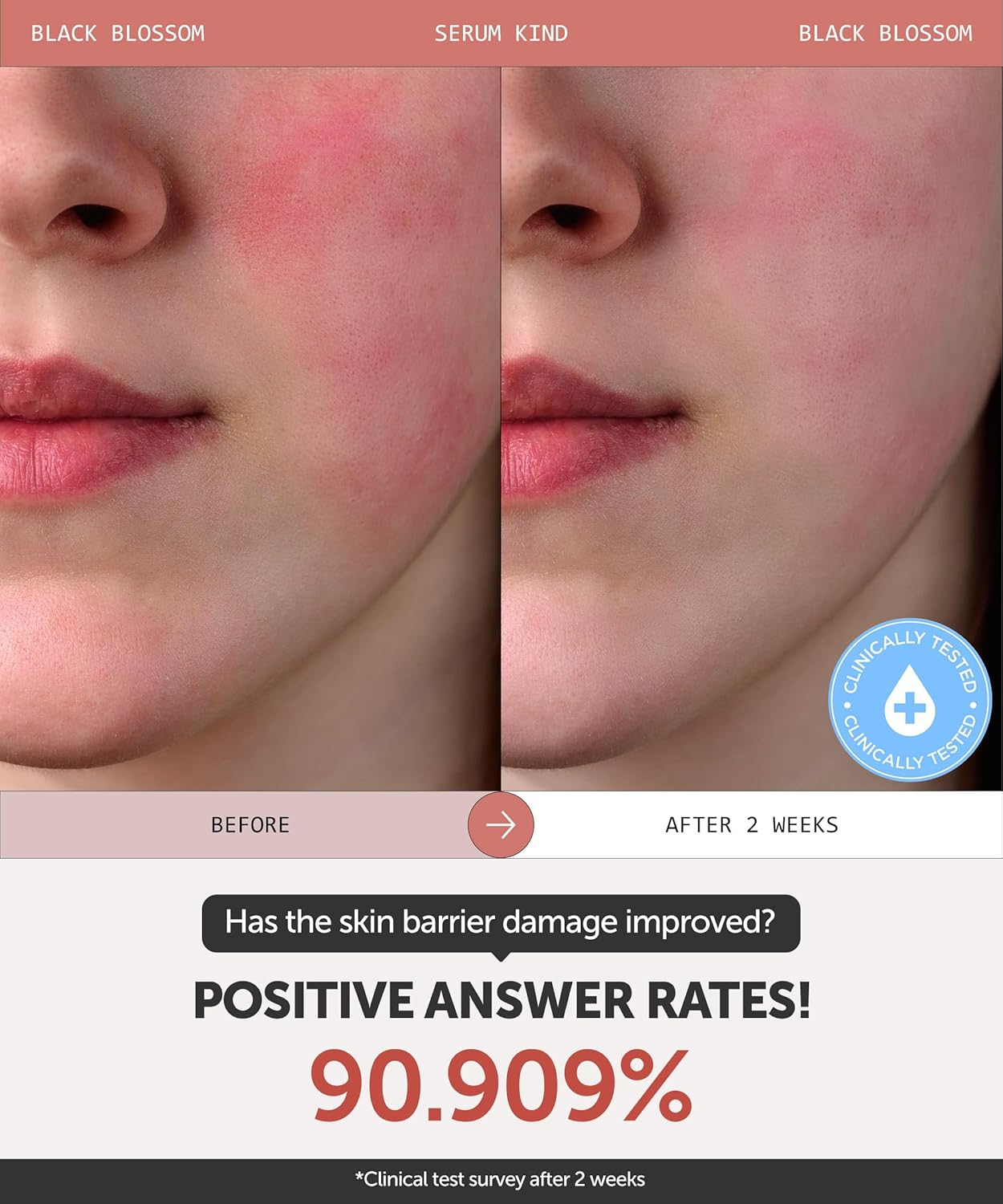 SERUMKIND Black Tulip Serum - Barrier Repair Antioxidant Korean Face Serum – Beta Glucan – Hydrating and Anti-aging – Vegan, Cruelty-Free, Unscented – 1.01 fl.oz.