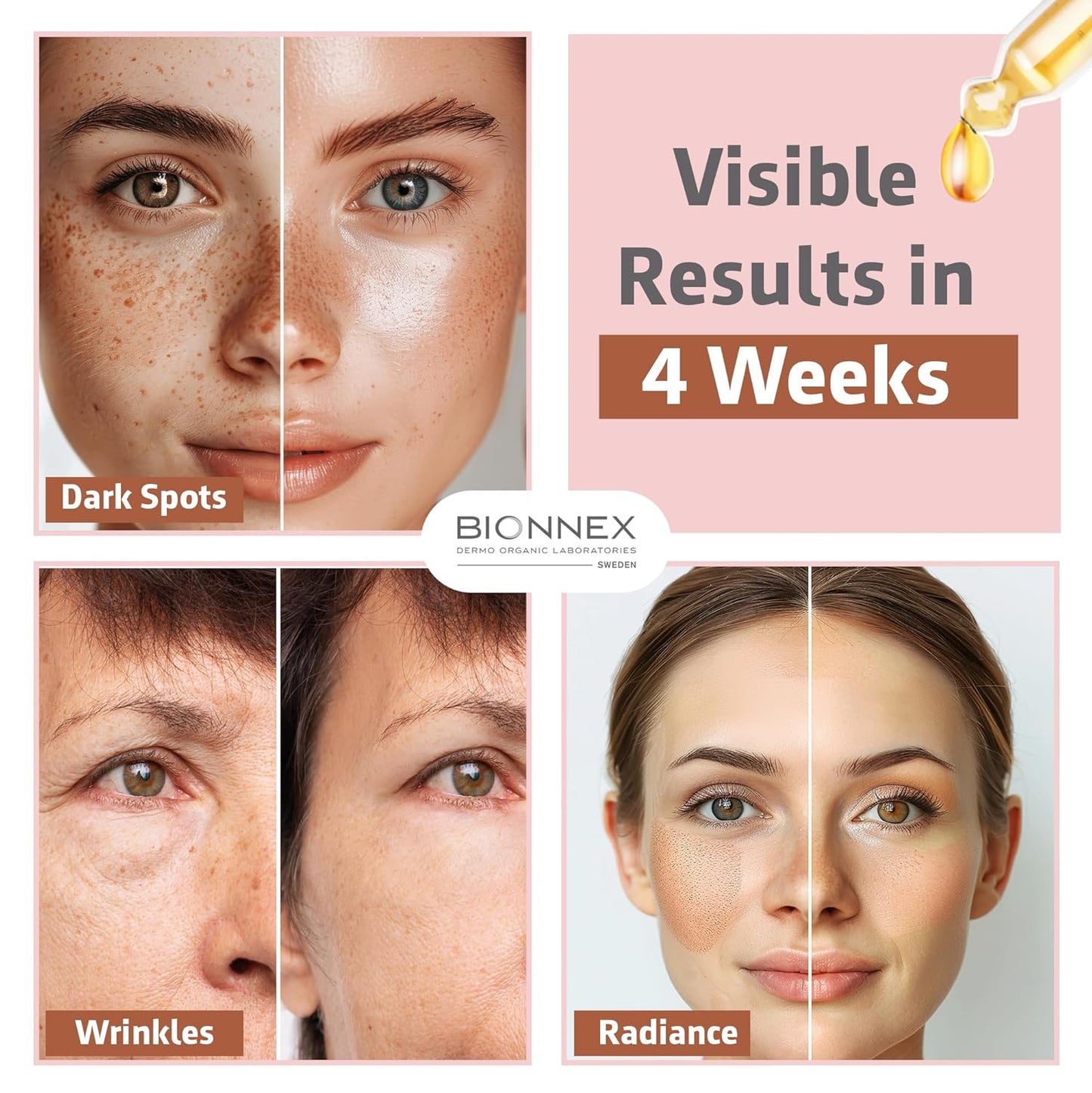 The nordea - 5% Caffeine Serum Angelica - Anti-Aging Eye Serum for Dark Circles, Puffiness and Wrinkles - Caffeine Eye Serum Natural and Vegan - 30 ml (5% Caffeine Skin Serum)