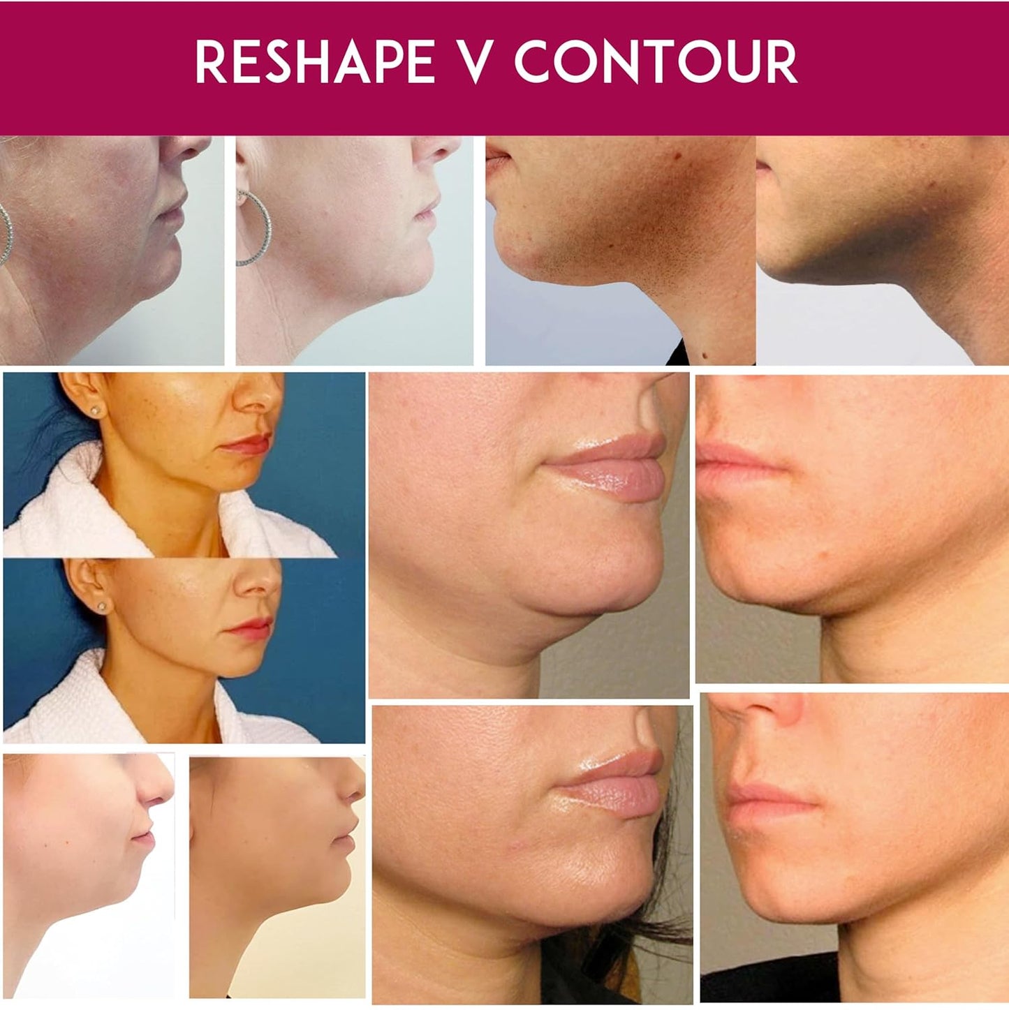 Facial Mask - Works for V-line Neck Chin Jawline - Fine Lines - Neck Wrinkles - Sagging Skin - for Women and Men - 5 Face Masks