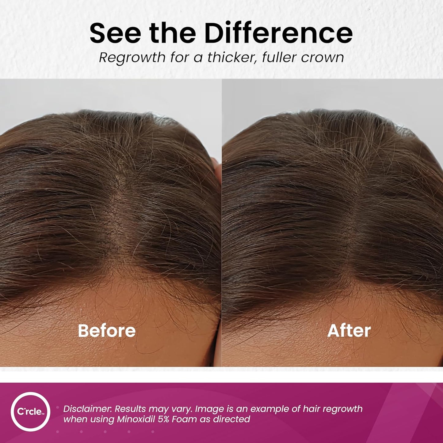 C'rcle Minoxidil for Women 5% Foam - Helps Restore Top of Scalp Hair Loss and Support Hair Growth for Women, Regrowth with Unscented Topical Treatment for Thinning Hair (5% Foam 8-Month Supply)