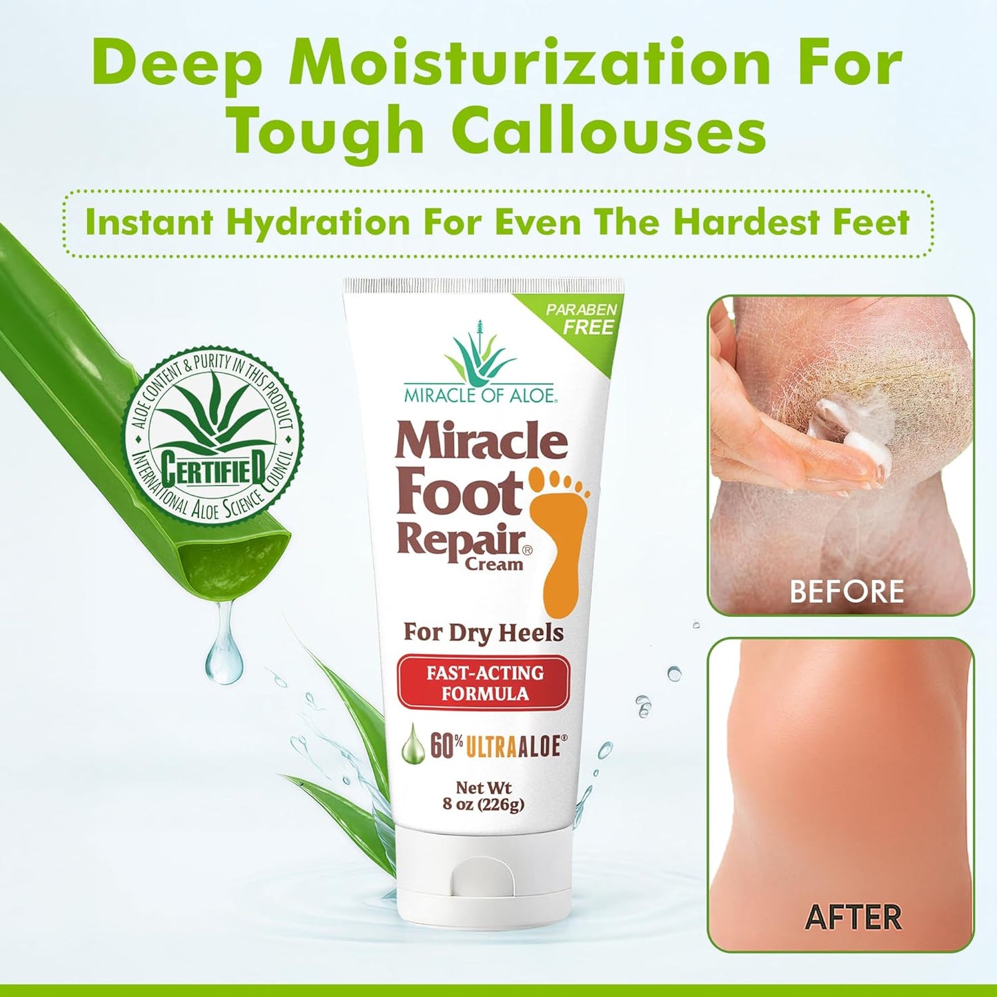 Miracle Foot Repair Cream (8 oz / 3-Pack) Repairs Dry Cracked Heels and Feet, 60% Pure UltraAloe Moisturizes, Softens, and Repairs