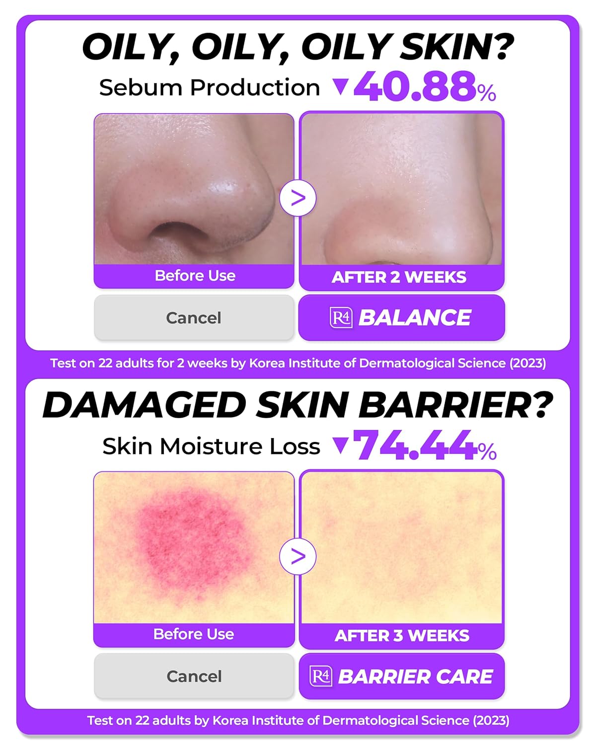 Soothing Repair Face Toner R4 | Hydrating Moisturizing & Soothing Toner for Skin Troubles w/Eucalyptus, Peptide & Collagen | Gentle for All Skin Types No Animal Trials No Paraben 6.76 fl oz