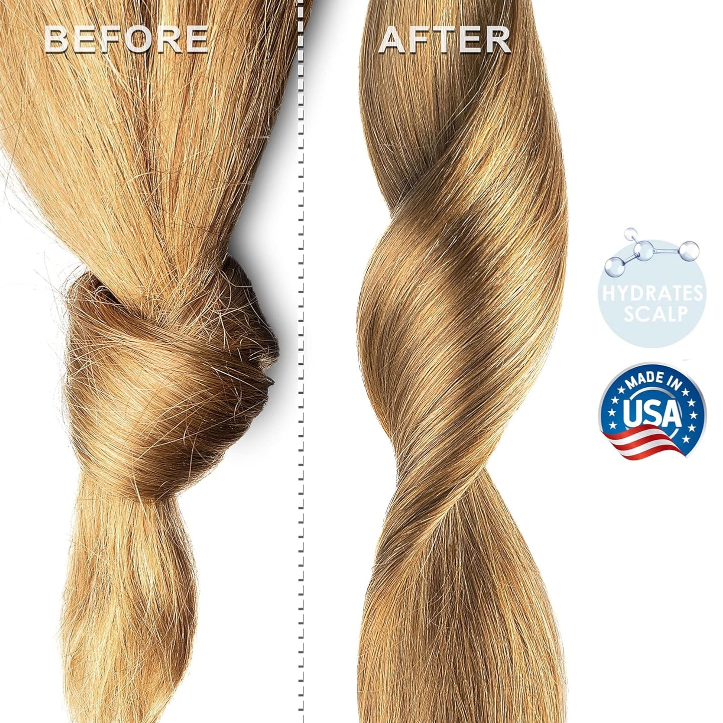 Soapeauty FRACTIONATED COCONUT OIL Cold Pressed Refined | 100% Natural Available in Bulk | Carrier for Essential Oils, Face, Skin, Hair Moisturizer, Soap Making | 32 fl oz